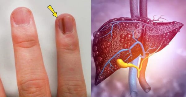 4 điểm lạ trên bàn tay, 2 bất thường trên mặt cảnh báo lá ...