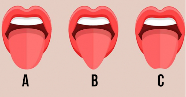 LƯỠI CHẺ ĐÔI Ở NGƯỜI CÓ THỂ XUẤT PHÁT TỪ YẾU TỐ DI TRUYỀN HOẶC BIẾN ĐỔI PHÔI THAI