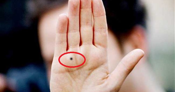 Mụn ruồi ở tay có thể đưa ra dự đoán về tương lai hay không?
