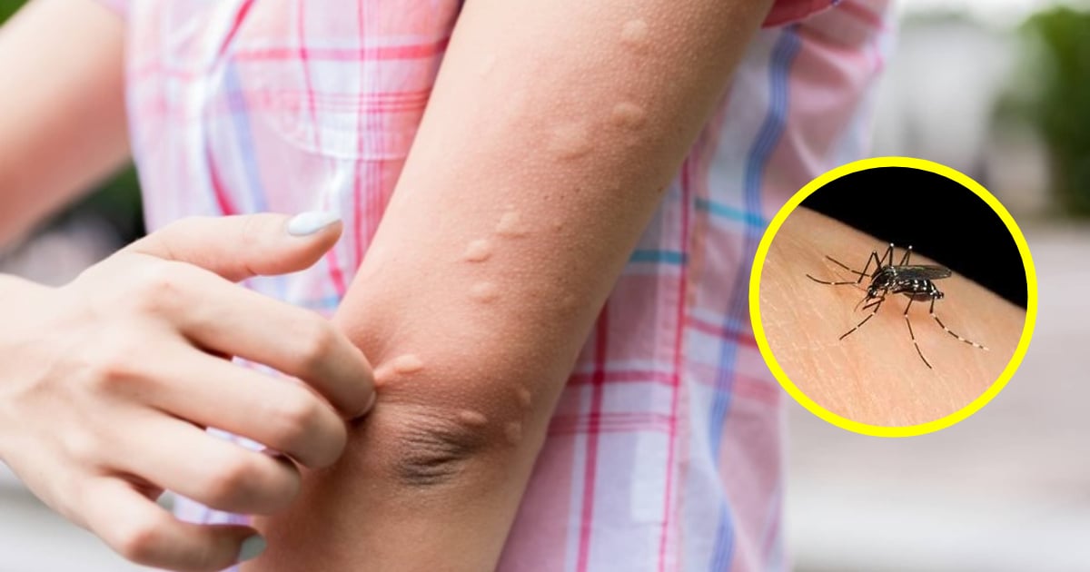 Muốn tránh bị muỗi đốt, hãy mặc quần áo có những màu này