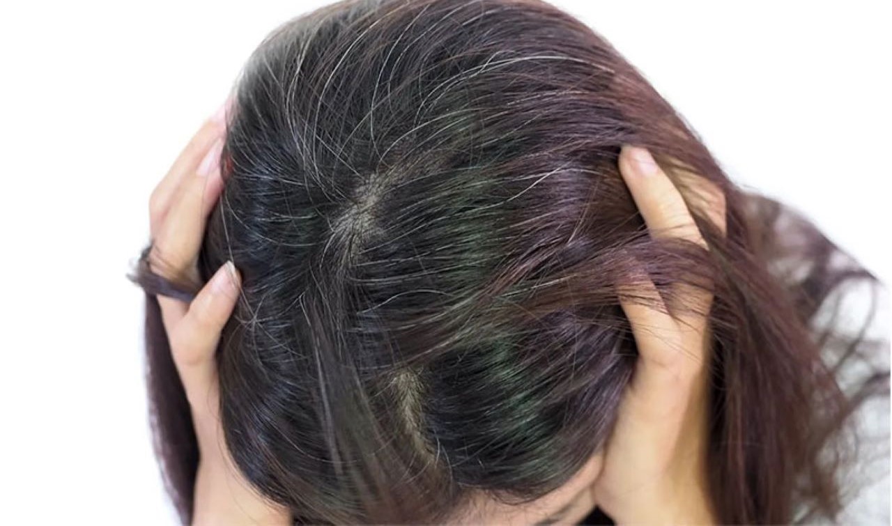 Trẻ em bị tóc bạc sớm là bệnh gì? Cách điều trị tận gốc cho trẻ