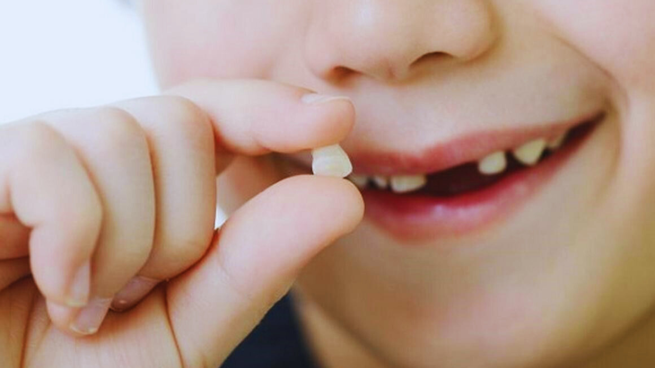 Nằm mơ bị rụng răng là điềm báo lành hay dữ? Nó có ý nghĩa gì?